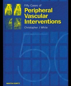 (Ebook PDF) Fifty Cases of Peripheral Vascular Interventions 1st Edition by Christopher White 184184098X 9781841840987 Full chapter