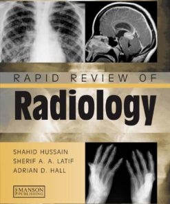 Rapid Review of Radiology 1st Edition Shahid Hussain